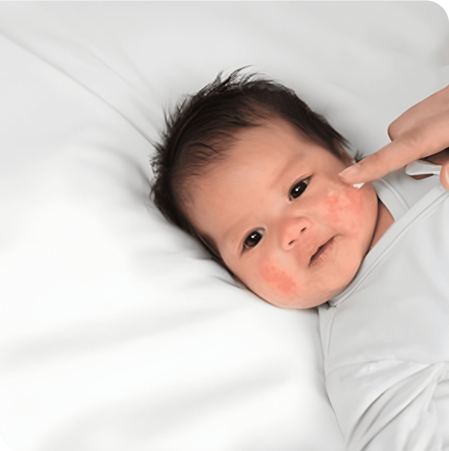 Pipi Rash How to spot nappy rash? - Sudocrem Indonesia