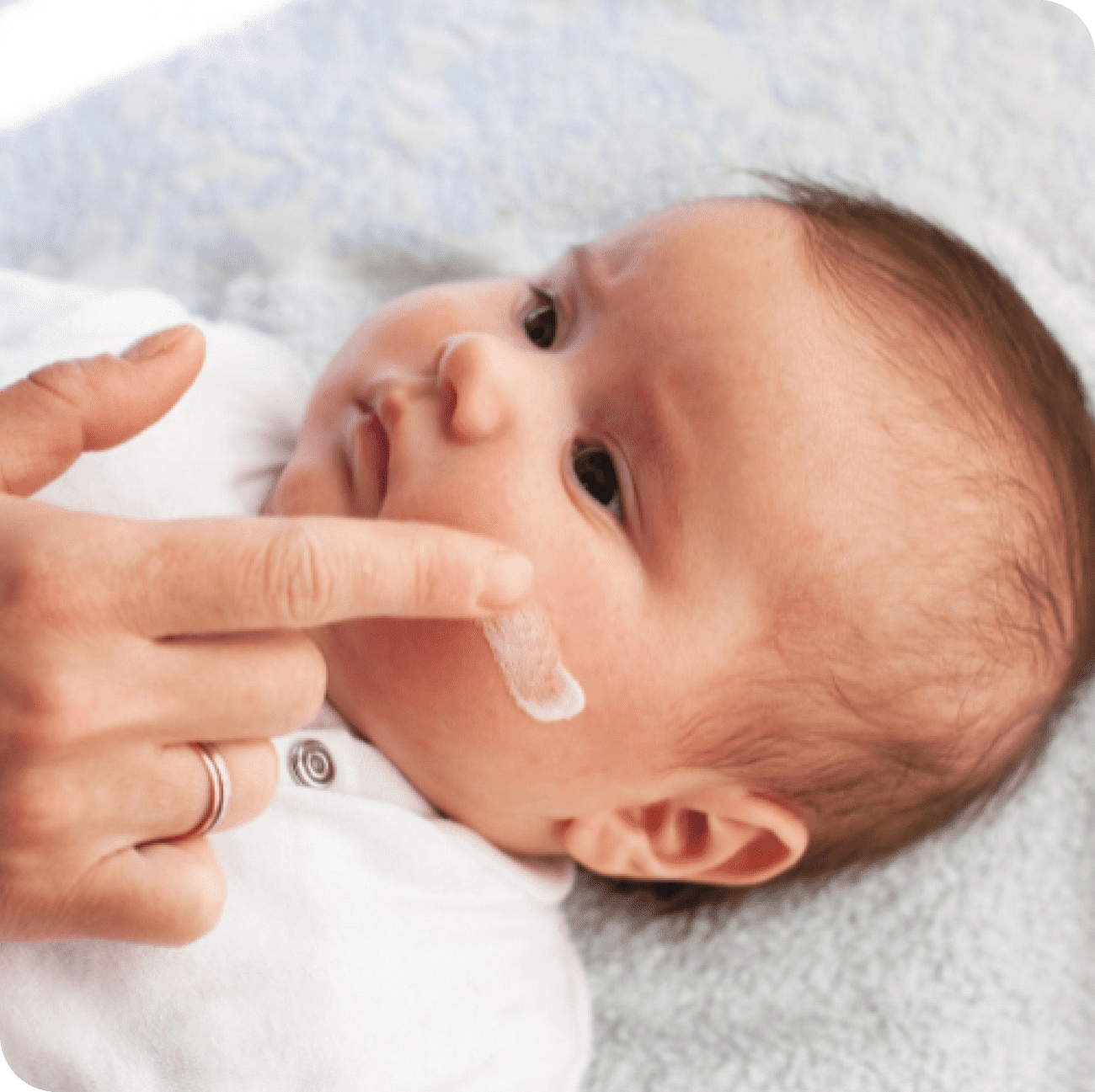 Pipi Rash How to spot nappy rash? - Sudocrem Indonesia